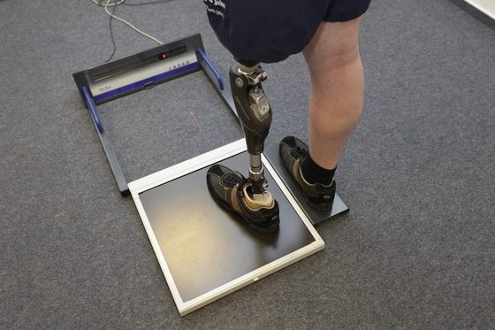 Einem Patienten wird eine Beinprothese für den linken Unterschenkel angepasst.