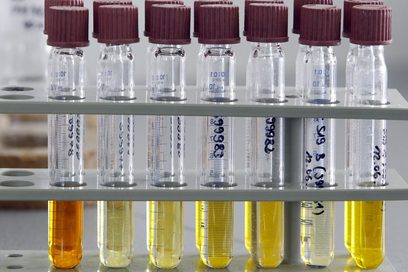 In einem Labor stehen in einem Reagenzglashalter mehrere Reagenzgläser.