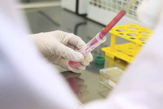 In einem Labor hält eine Hand im Gummihandschuh ein Reagenzröhrchen, in das eine Pipette mit einer roten Flüssigkeit gehalten wird.