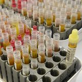 Urinproben stehen in einem Rack auf einem Labortisch