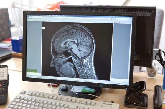 CT-Aufnahme eines Kopfes auf einem Bildschirm.